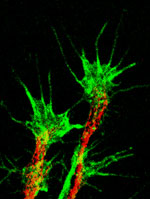 Actin rich growth cones (green) projecting from ends of axons (red)